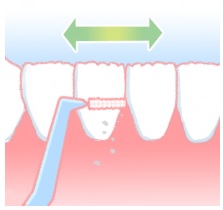 歯間ブラシの動かし方