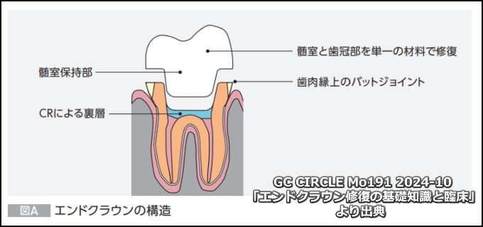 エンドクラウンの構造
