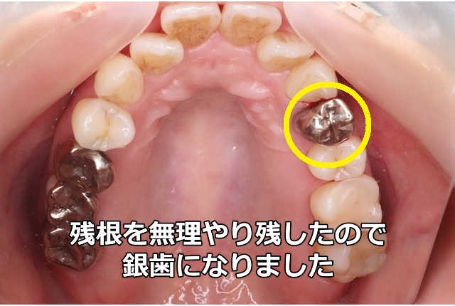 セットしたＦＭＣ