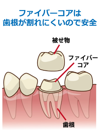ファイバーコアの構造図