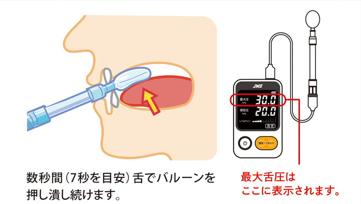 舌圧測定器の使用方法