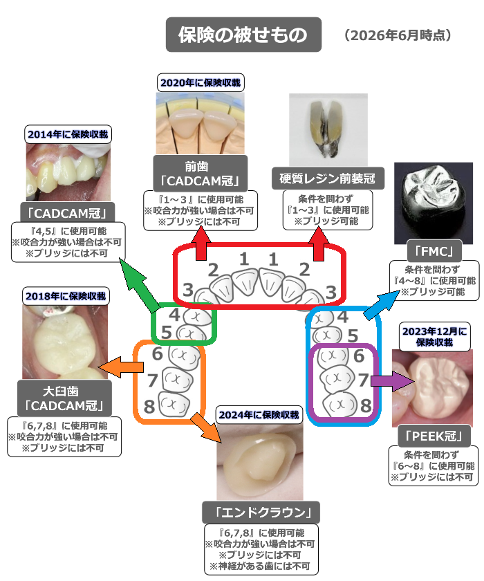 保険の被せもの一覧（2026年6月）