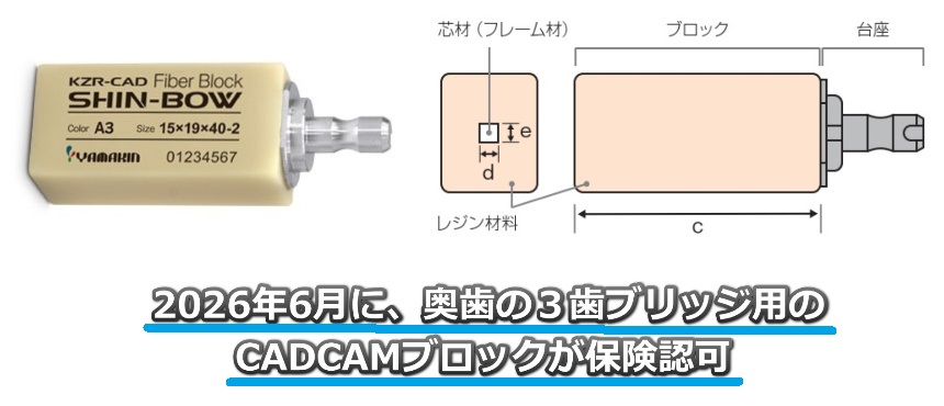 奥歯ブリッジ用のCADCAMブロック