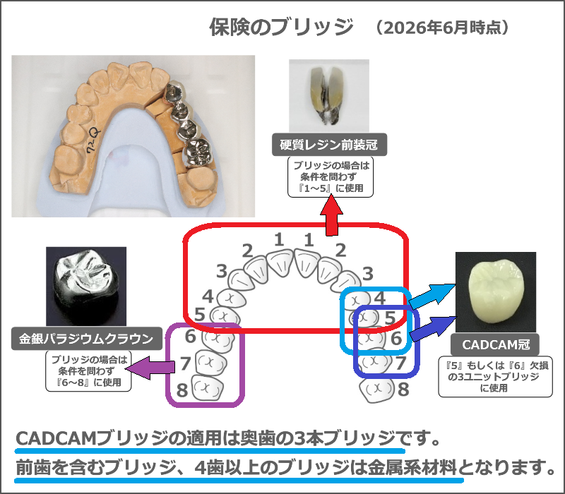 保険のブリッジの適用条件