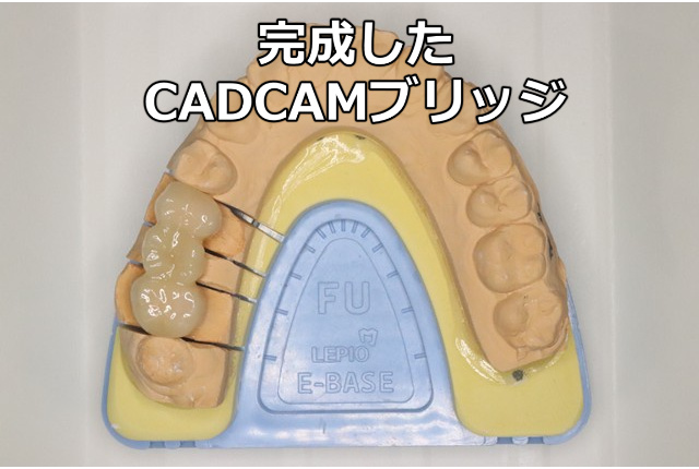 完成したCADCAMブリッジ
