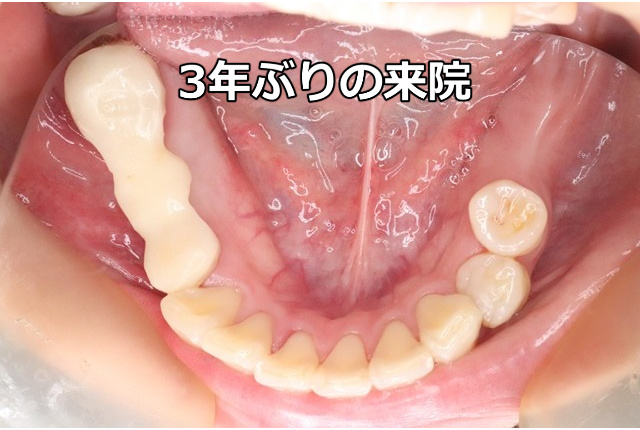 3年ぶりの来院