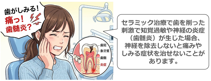 歯がしみている女性
