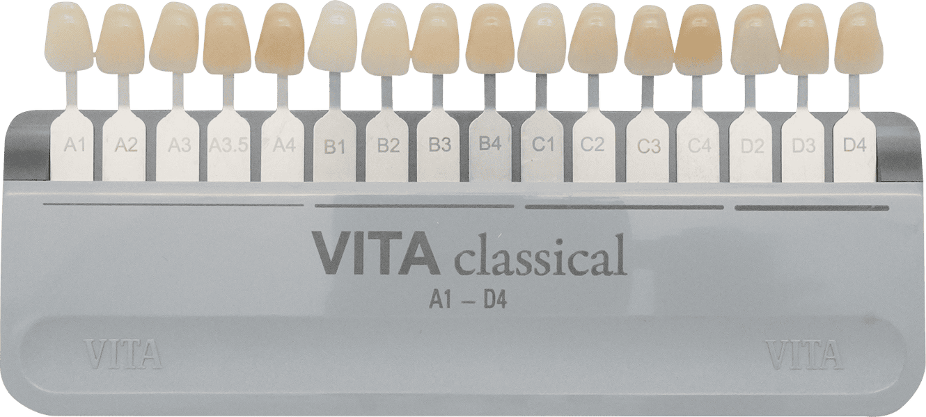 Vitaクラシカルシェードガイド