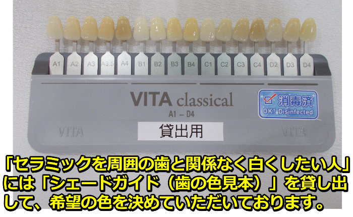 貸出用のVitaクラシカルシェード
